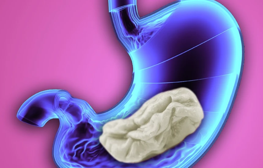 Kaugummi schlucken: Bleibt die Masse wirklich sieben Jahre lang im Körper stecken?